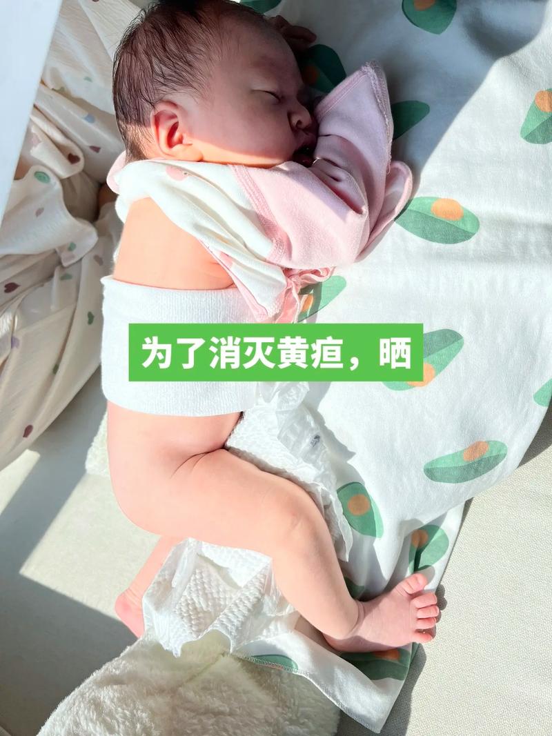 新生儿黄疸喝白糖水有用吗？-第2张图片-中州医学会