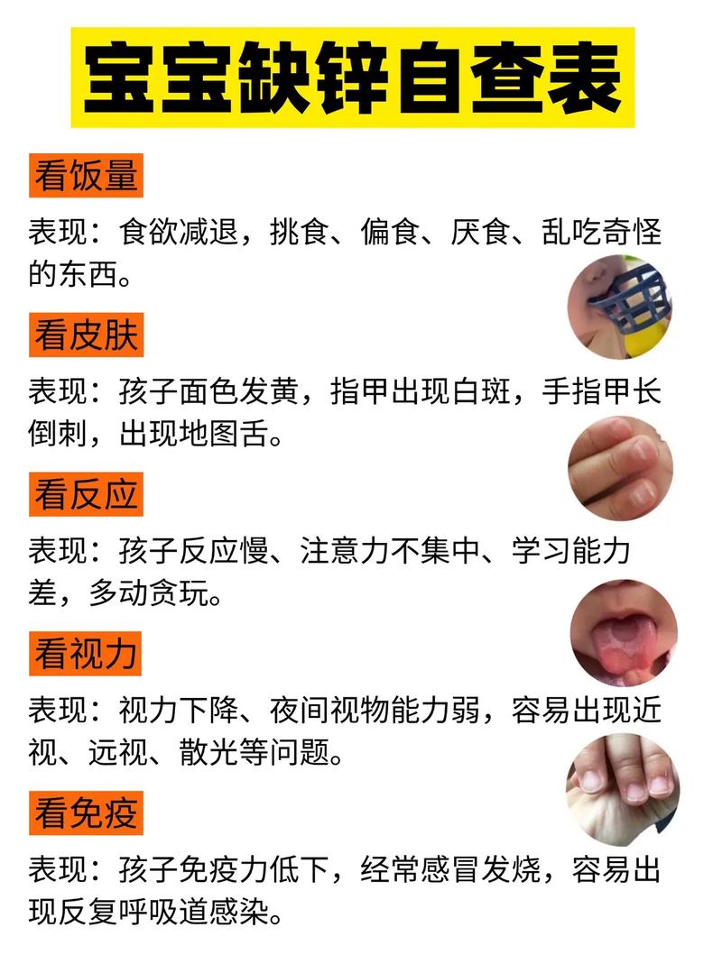 儿童缺铁有哪些症状？-第3张图片-郑州医学网