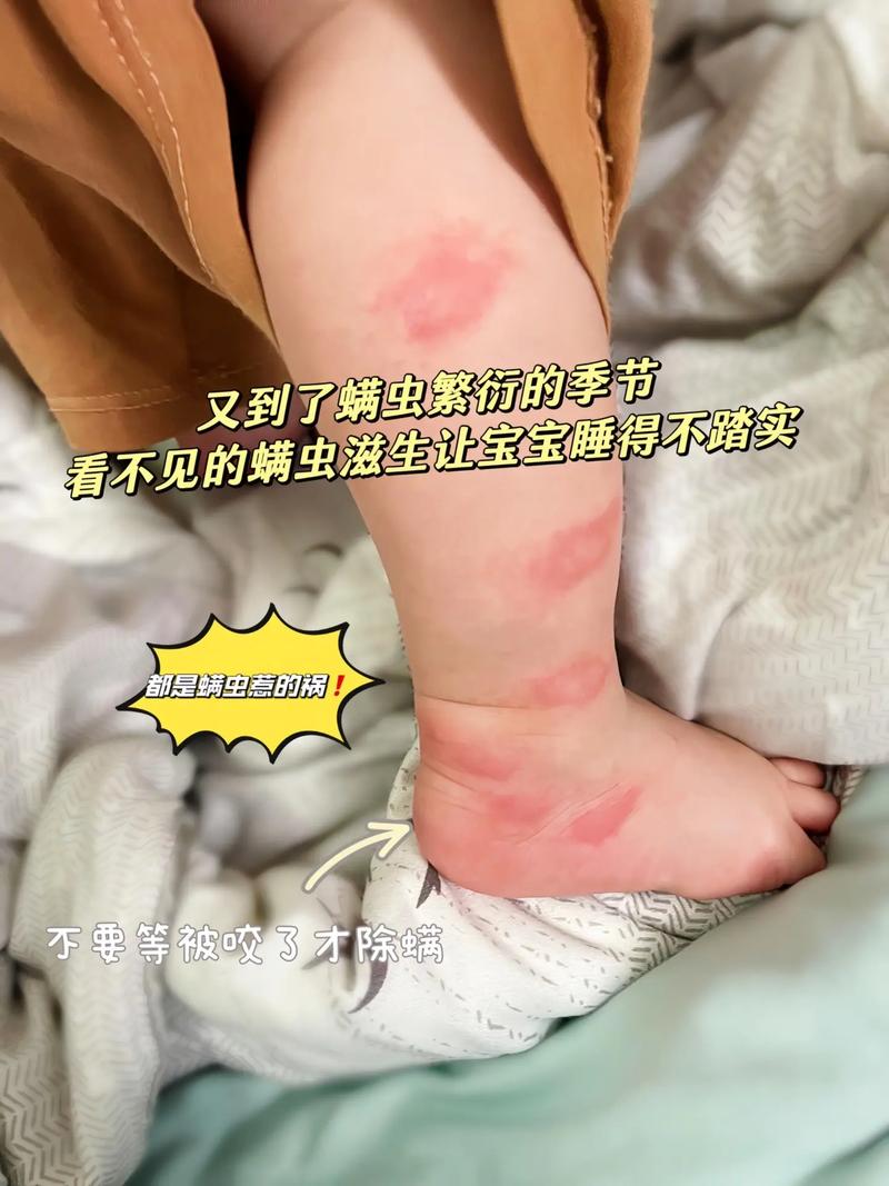 儿童睡眠癫疯病早期症状有哪些?-第1张图片-郑州医学网 儿童睡眠癫疯病早期症状有哪些?-第1张图片-郑州医学网