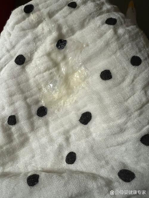 新生儿呛奶后喉咙有痰怎么办?-第1张图片-郑州医学网 新生儿呛奶后喉咙有痰怎么办?-第1张图片-郑州医学网