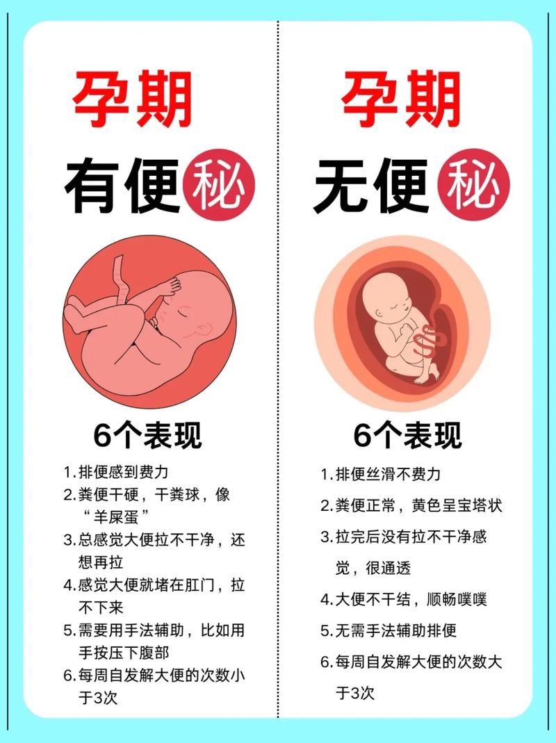 孕期便秘频发,该如何有效缓解?-第1张图片-郑州医学网 孕期便秘频发,该如何有效缓解?-第1张图片-郑州医学网