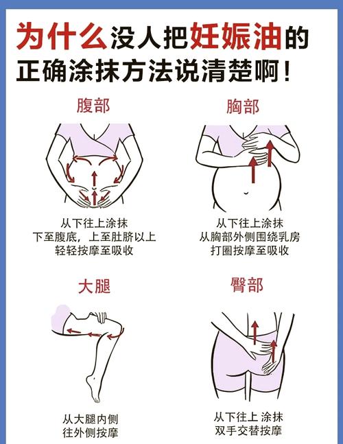 孕期如何有效防妊娠纹？-第1张图片-中州医学会