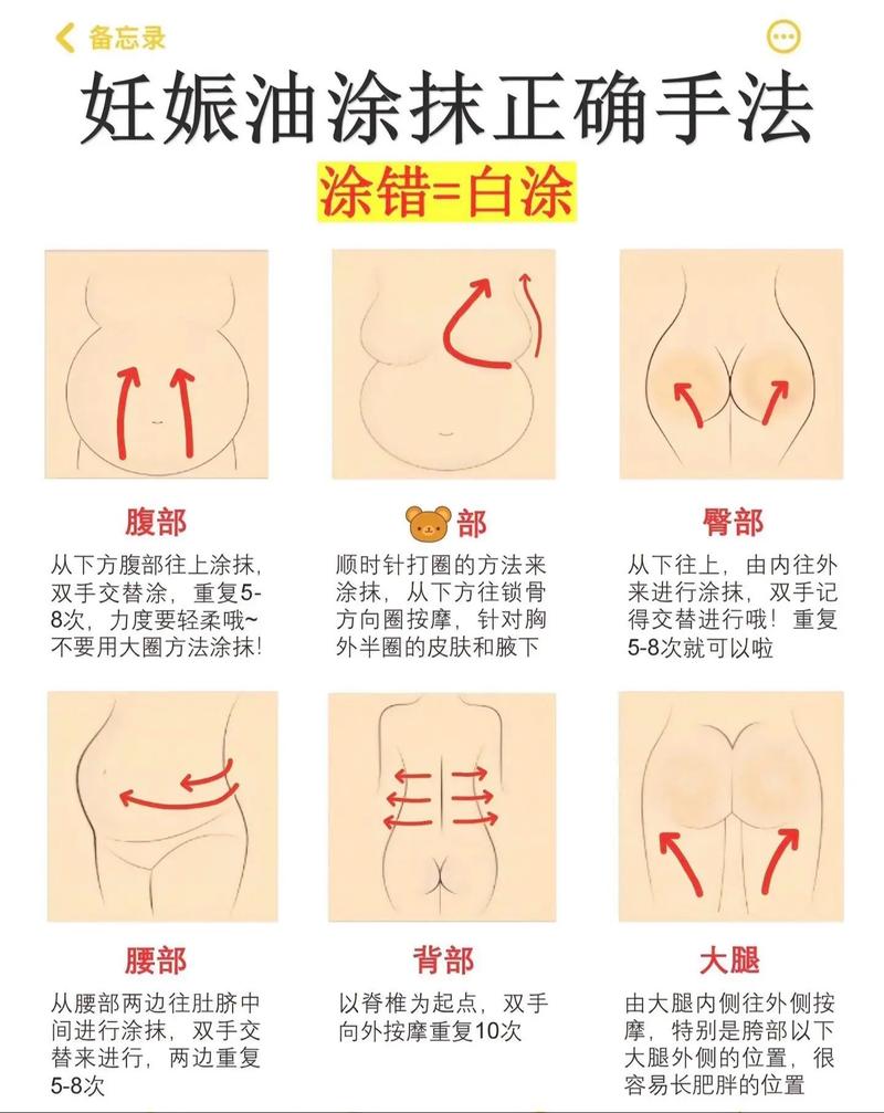 孕期如何有效防妊娠纹？-第3张图片-中州医学会