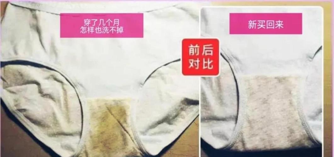 孕期内裤发黄是正常现象吗？-第3张图片-郑州医学网