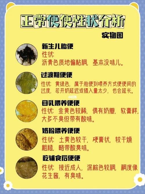 新生儿几天不拉便便是异常?-第3张图片-中州医学会 新生儿几天不拉便便是异常?-第3张图片-中州医学会