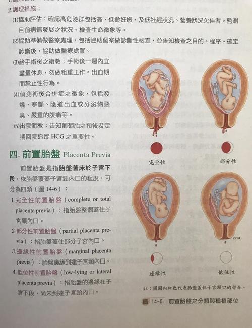 胎盘位置孕期会变吗？-第1张图片-郑州医学网