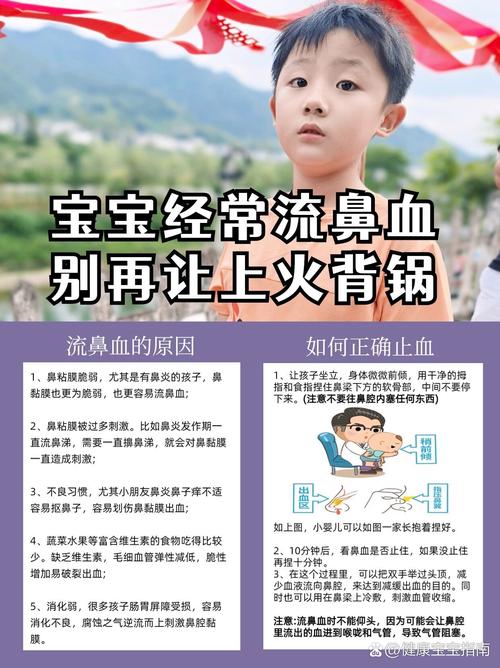 儿童流鼻血时,正确的紧急处理方法是什么?-第2张图片-郑州医学网 儿童流鼻血时,正确的紧急处理方法是什么?-第2张图片-郑州医学网