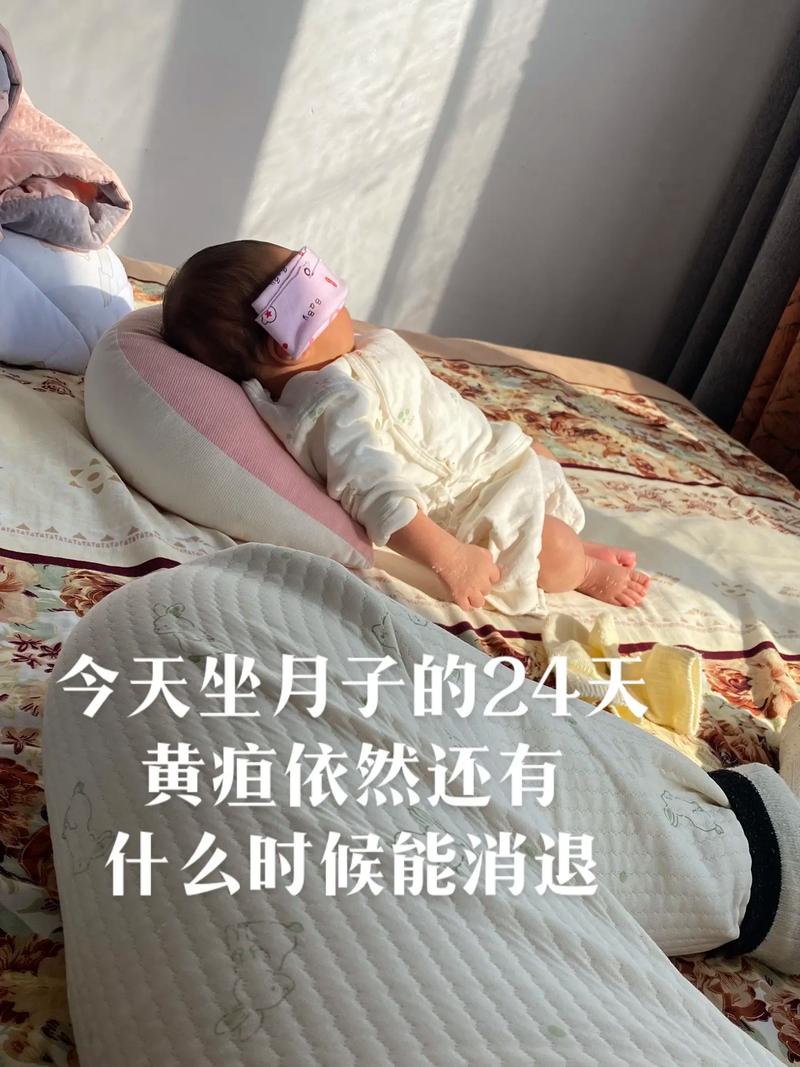 新生儿黄疸晒太阳多久合适？-第3张图片-中州医学会