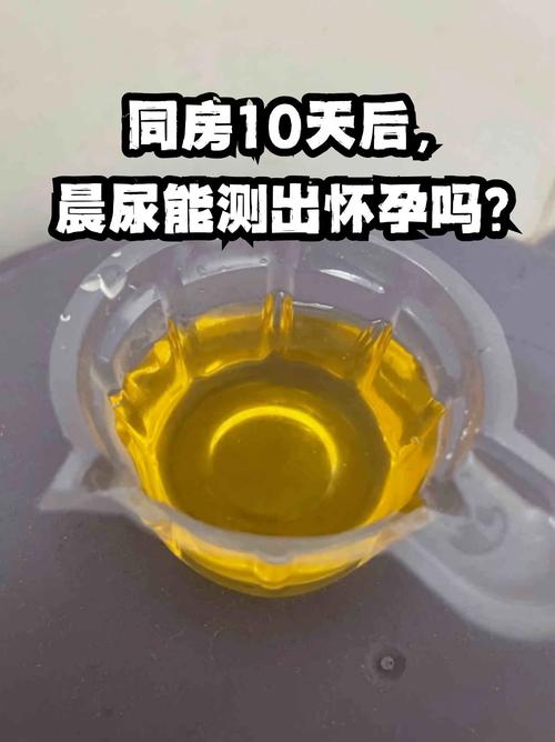 孕期尿频是正常现象吗？-第2张图片-郑州医学网