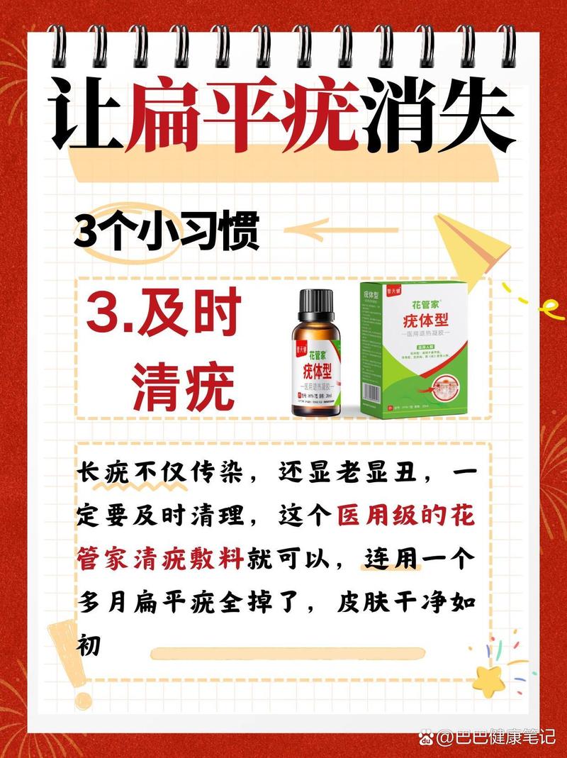 孕期长扁平疣怎么治？-第3张图片-郑州医学网