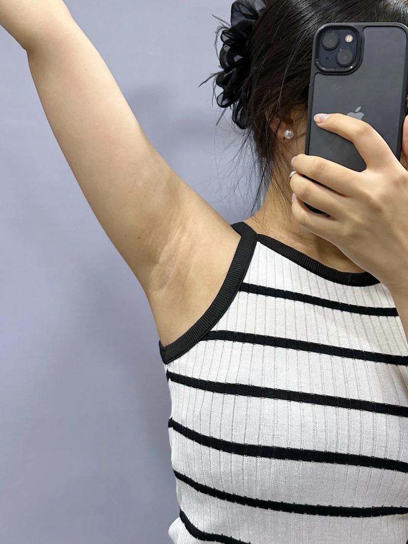 备孕期脱腋毛安全吗？-第3张图片-郑州医学网