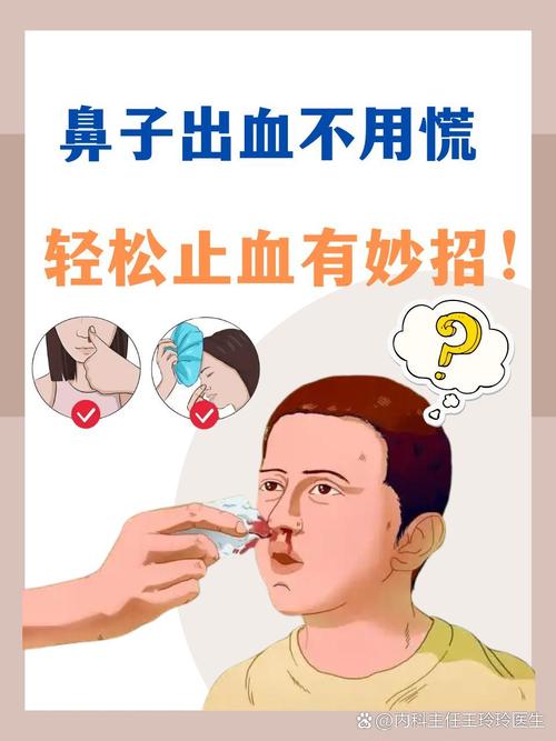 儿童鼻子经常出血是上火还是疾病信号？日常护理该注意什么？-第2张图片-郑州医学网