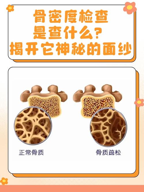 儿童骨密度检查真的有必要吗?过度检查还是健康保障?-第2张图片-郑州医学网 儿童骨密度检查真的有必要吗?过度检查还是健康保障?-第2张图片-郑州医学网