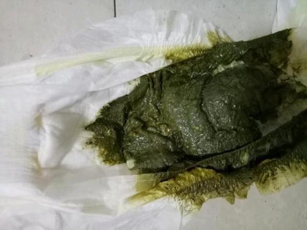 新生儿大便发绿是正常现象还是健康警报?背后隐藏哪些喂养或消化问题?-第2张图片-郑州医学网 新生儿大便发绿是正常现象还是健康警报?背后隐藏哪些喂养或消化问题?-第2张图片-郑州医学网