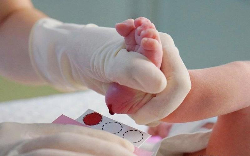 新生儿足跟血筛查TSH偏高意味着什么?需要进一步检查吗?-第2张图片-郑州医学网 新生儿足跟血筛查TSH偏高意味着什么?需要进一步检查吗?-第2张图片-郑州医学网