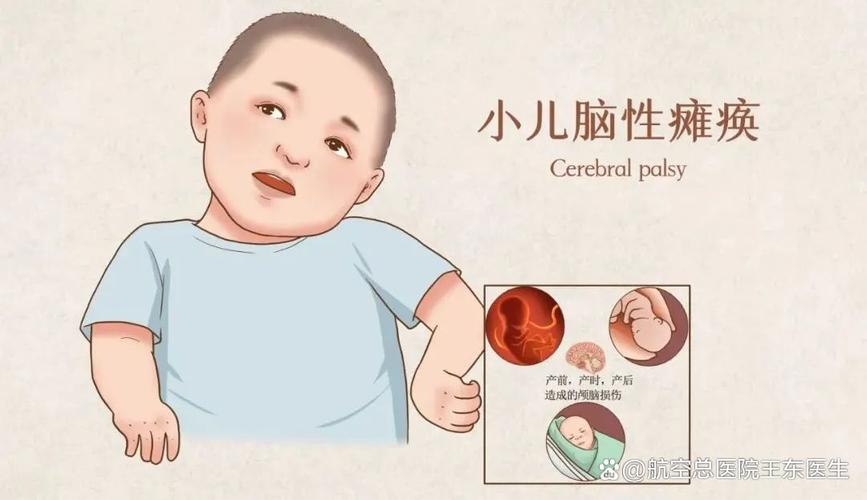 新生儿脑水肿声像图特征有哪些典型表现及诊断要点?-第1张图片-郑州医学网 新生儿脑水肿声像图特征有哪些典型表现及诊断要点?-第1张图片-郑州医学网