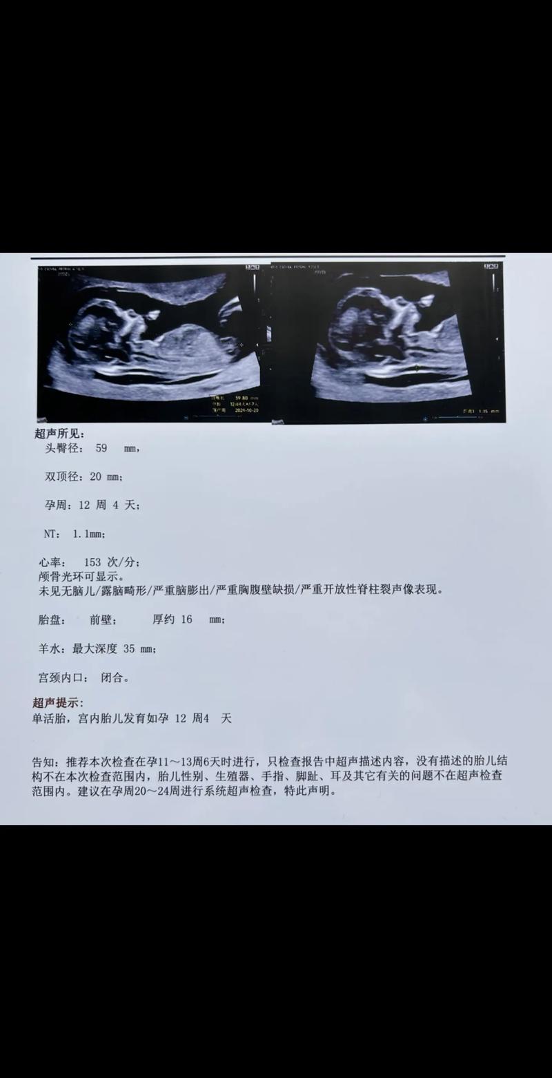 新生儿脑水肿声像图特征有哪些典型表现及诊断要点?-第2张图片-郑州医学网 新生儿脑水肿声像图特征有哪些典型表现及诊断要点?-第2张图片-郑州医学网