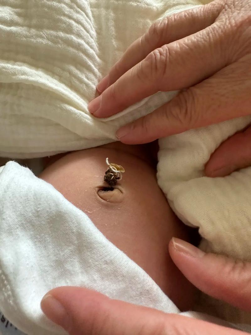 新生儿脐带脱落后洗澡,到底能不能碰水?该怎么护理才不会感染?-第3张图片-郑州医学网 新生儿脐带脱落后洗澡,到底能不能碰水?该怎么护理才不会感染?-第3张图片-郑州医学网