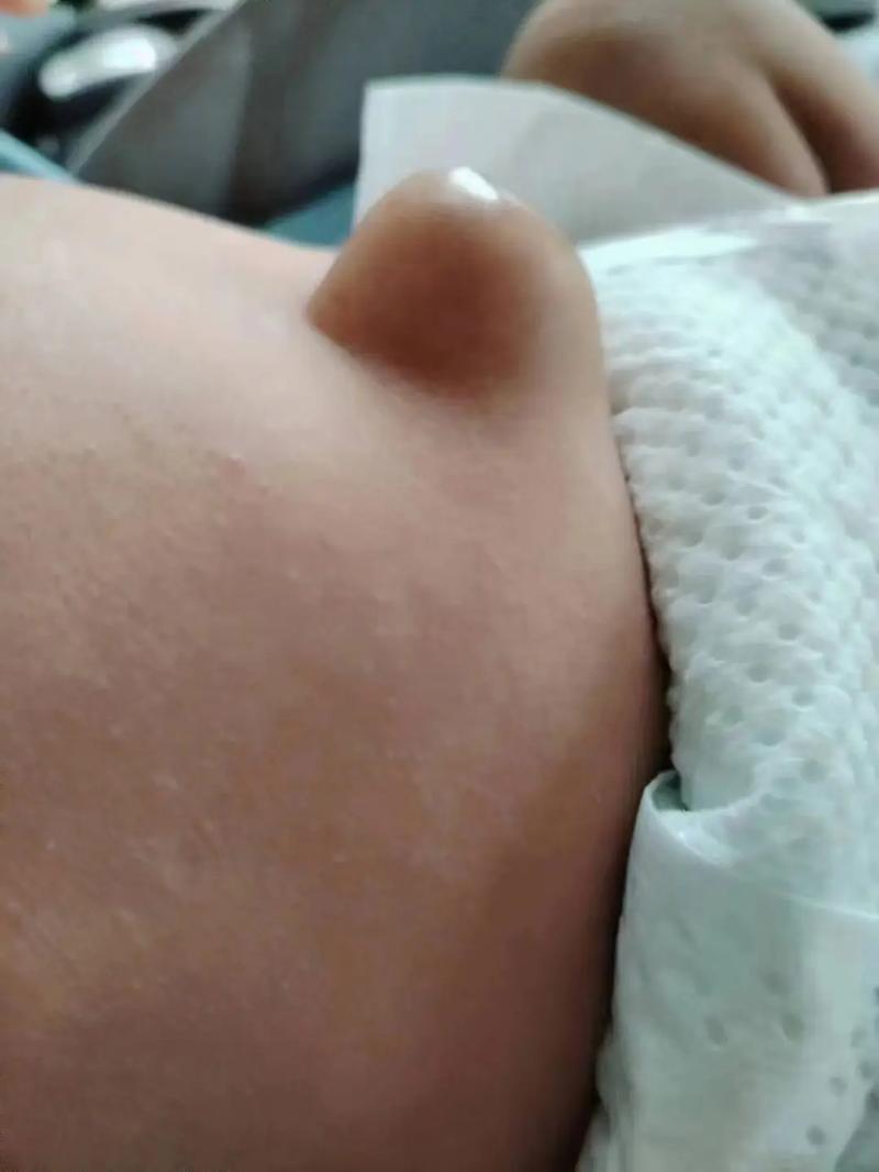 新生儿肚皮硬硬鼓鼓是胀气还是疾病信号？家长该如何应对？-第3张图片-郑州医学网