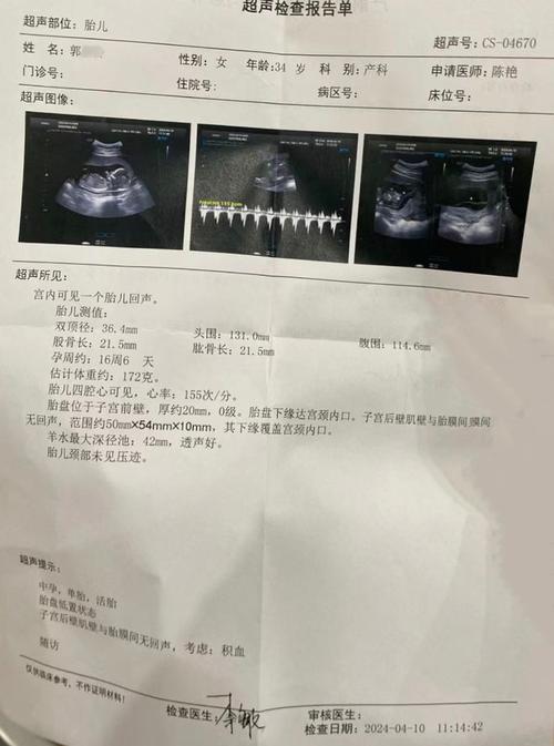 孕期分泌物检查后出血，是正常反应还是异常信号？需要立即就医吗？-第1张图片-郑州医学网