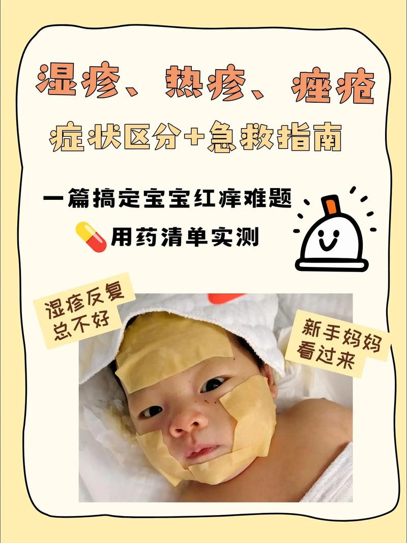 儿童脸湿疹反复发作,家长该如何科学护理与有效治疗?-第2张图片-郑州医学网 儿童脸湿疹反复发作,家长该如何科学护理与有效治疗?-第2张图片-郑州医学网