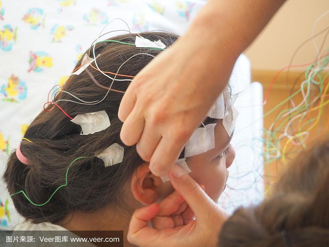 儿童脑电图能检查出哪些大脑异常问题？-第3张图片-郑州医学网