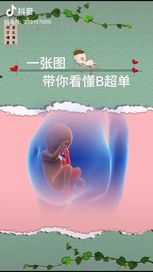 孕期频繁做B超安全吗？会对胎儿发育有影响吗？-第3张图片-郑州医学网