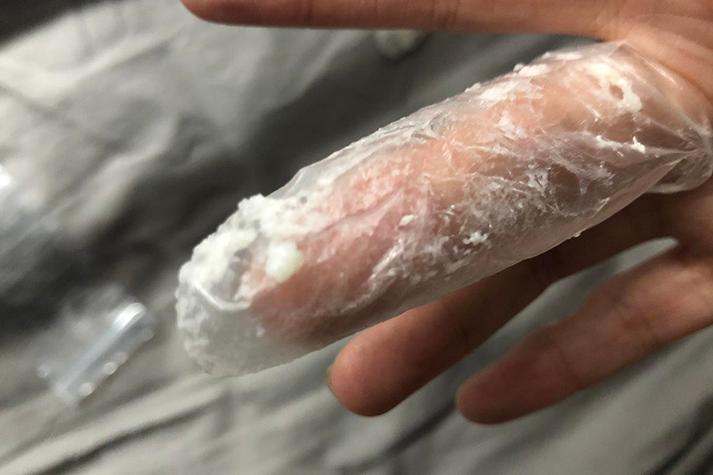 备孕期白带腥味豆腐渣是妇科炎症信号吗？会影响怀孕吗？-第2张图片-郑州医学网