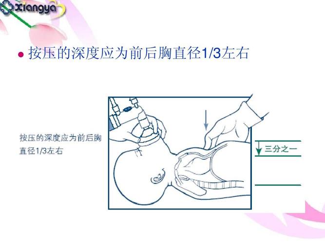 新生儿窒息复苏后护理的关键要点及注意事项有哪些？-第3张图片-郑州医学网