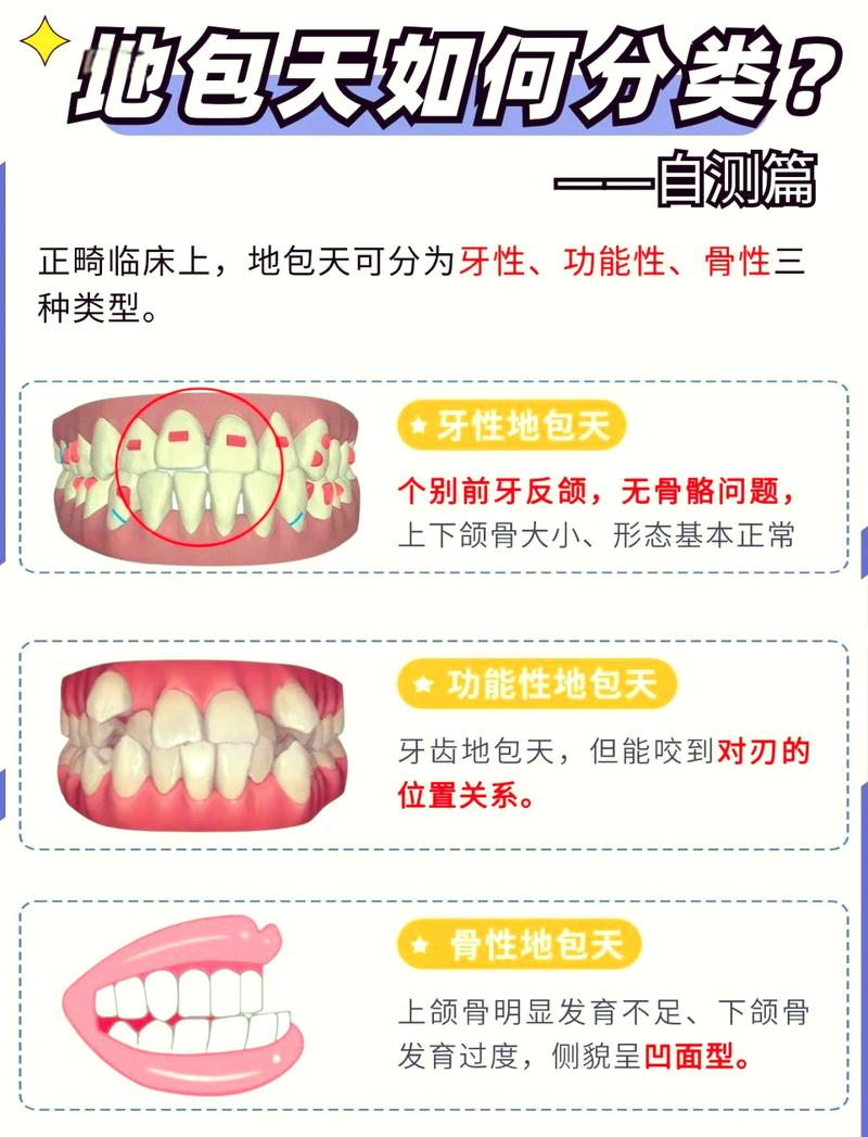 儿童地包天矫正最佳年龄是几岁?过早或过晚矫正会有哪些影响?-第2张图片-郑州医学网 儿童地包天矫正最佳年龄是几岁?过早或过晚矫正会有哪些影响?-第2张图片-郑州医学网