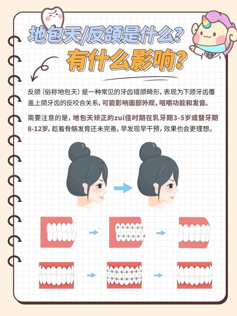儿童地包天矫正最佳年龄是几岁?过早或过晚矫正会有哪些影响?-第1张图片-郑州医学网 儿童地包天矫正最佳年龄是几岁?过早或过晚矫正会有哪些影响?-第1张图片-郑州医学网