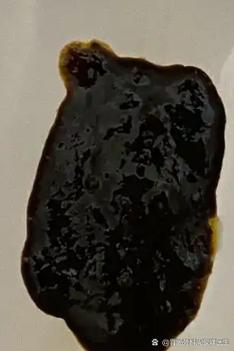 新生儿大便出现黑色颗粒是正常现象还是需要警惕的健康信号?-第2张图片-郑州医学网 新生儿大便出现黑色颗粒是正常现象还是需要警惕的健康信号?-第2张图片-郑州医学网