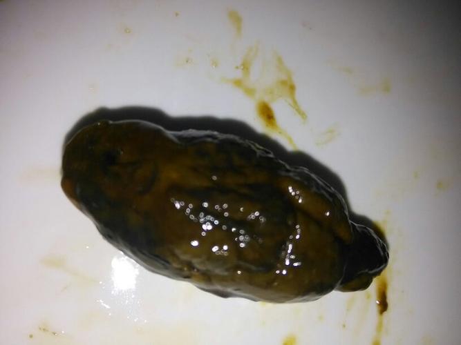 新生儿大便出现黑色颗粒是正常现象还是需要警惕的健康信号?-第1张图片-郑州医学网 新生儿大便出现黑色颗粒是正常现象还是需要警惕的健康信号?-第1张图片-郑州医学网