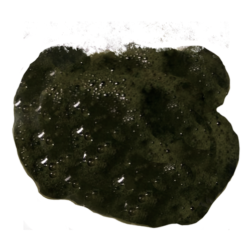 新生儿大便出现黑色颗粒是正常现象还是需要警惕的健康信号?-第3张图片-郑州医学网 新生儿大便出现黑色颗粒是正常现象还是需要警惕的健康信号?-第3张图片-郑州医学网