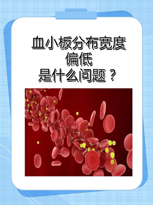 儿童血小板分布宽度偏低是哪些原因导致的?需要家长如何应对?-第1张图片-郑州医学网 儿童血小板分布宽度偏低是哪些原因导致的?需要家长如何应对?-第1张图片-郑州医学网