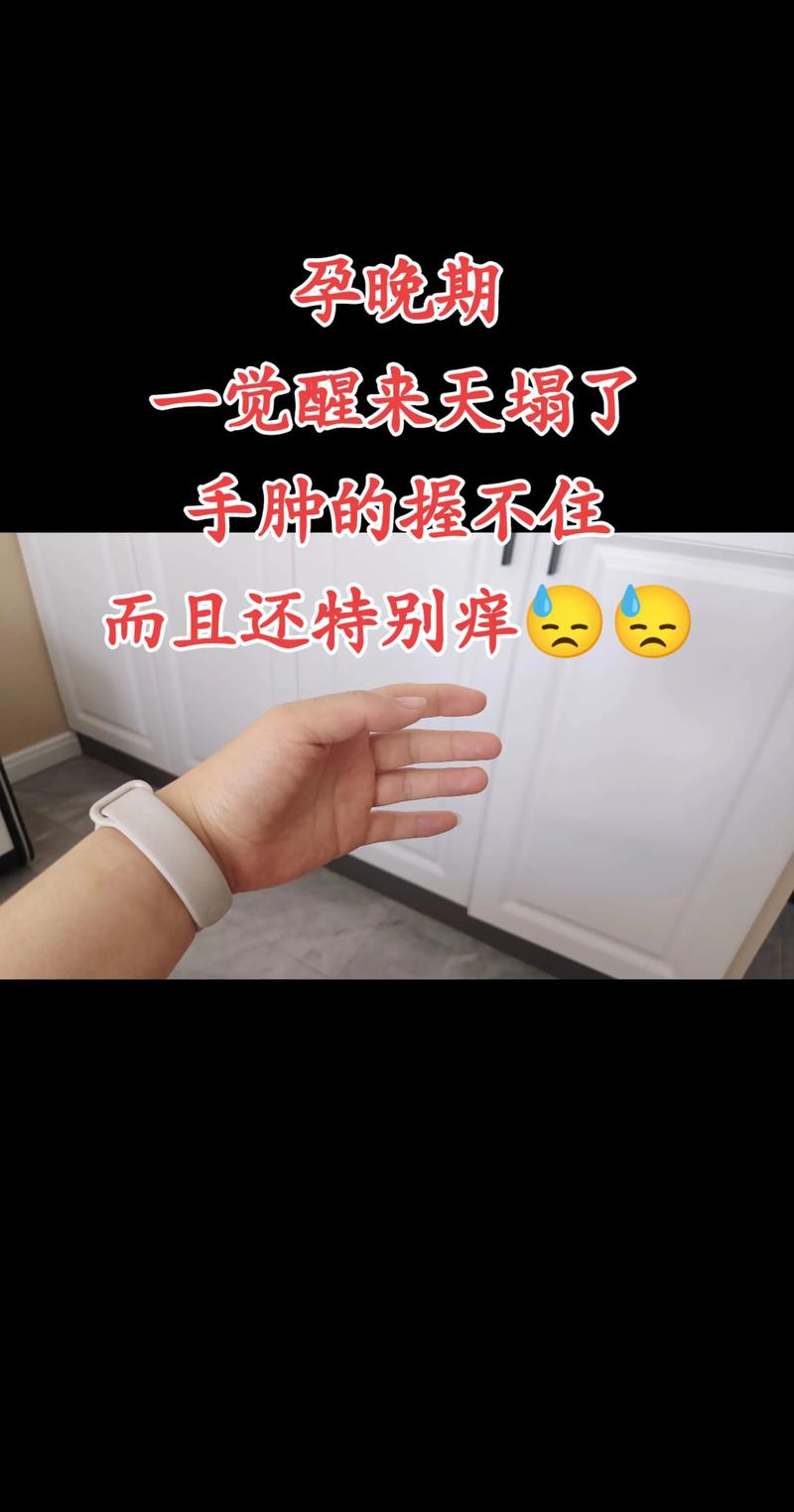 孕期手肿发痒是正常现象吗?需警惕哪些潜在健康问题?-第1张图片-郑州医学网 孕期手肿发痒是正常现象吗?需警惕哪些潜在健康问题?-第1张图片-郑州医学网