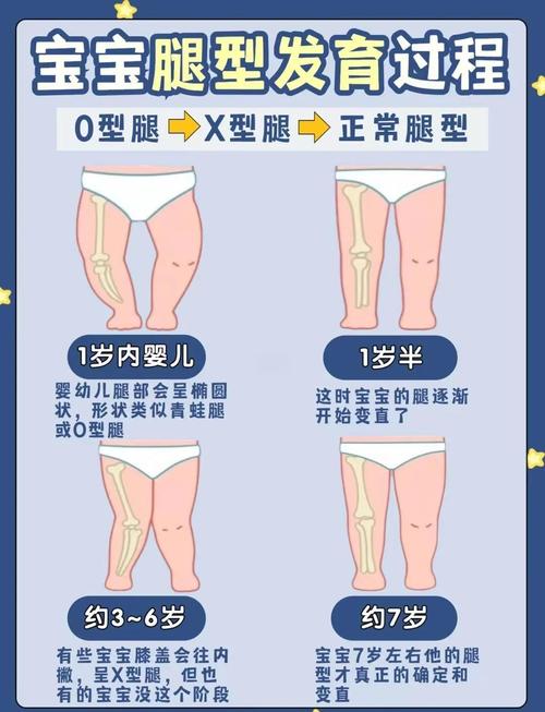 6岁儿童O型腿矫正黄金期是什么时候?有哪些安全有效的方法?-第3张图片-郑州医学网 6岁儿童O型腿矫正黄金期是什么时候?有哪些安全有效的方法?-第3张图片-郑州医学网