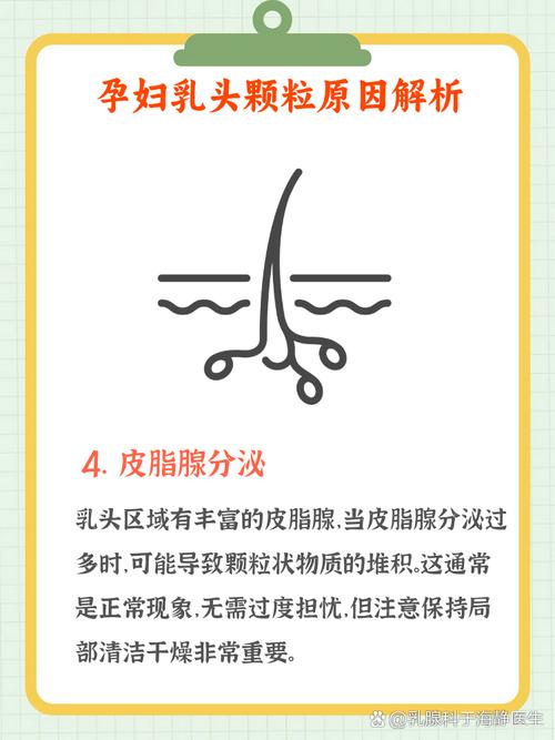 孕期乳腺长皮脂腺增生会影响哺乳吗？该如何正确护理？-第2张图片-郑州医学网