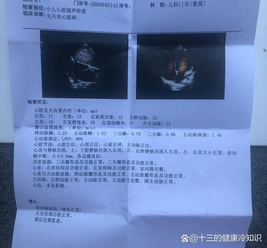 2mm新生儿房缺需要干预吗?能自行闭合吗?对生长发育有影响吗?-第2张图片-郑州医学网 2mm新生儿房缺需要干预吗?能自行闭合吗?对生长发育有影响吗?-第2张图片-郑州医学网