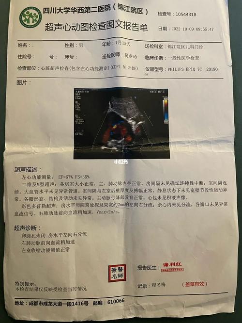 2mm新生儿房缺需要干预吗?能自行闭合吗?对生长发育有影响吗?-第3张图片-郑州医学网 2mm新生儿房缺需要干预吗?能自行闭合吗?对生长发育有影响吗?-第3张图片-郑州医学网