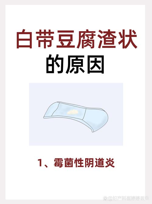 孕期白带呈豆渣样还痒,会不会是霉菌感染?对胎儿有影响吗?该怎么护理和治疗?-第3张图片-郑州医学网 孕期白带呈豆渣样还痒,会不会是霉菌感染?对胎儿有影响吗?该怎么护理和治疗?-第3张图片-郑州医学网
