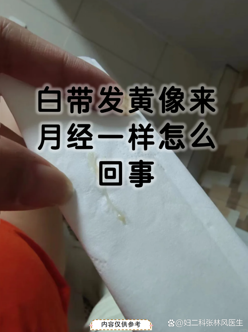 孕期白带发黄有腥臭味是感染了吗?对胎儿有影响吗?该怎么办?-第1张图片-郑州医学网 孕期白带发黄有腥臭味是感染了吗?对胎儿有影响吗?该怎么办?-第1张图片-郑州医学网