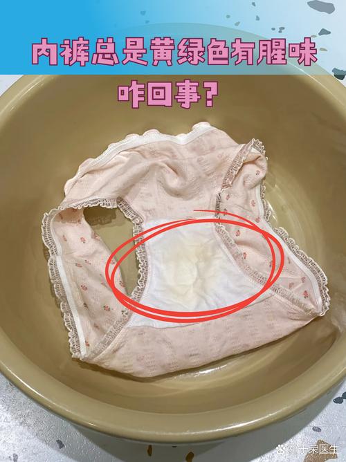 孕期白带发黄有腥臭味是感染了吗?对胎儿有影响吗?该怎么办?-第3张图片-郑州医学网 孕期白带发黄有腥臭味是感染了吗?对胎儿有影响吗?该怎么办?-第3张图片-郑州医学网