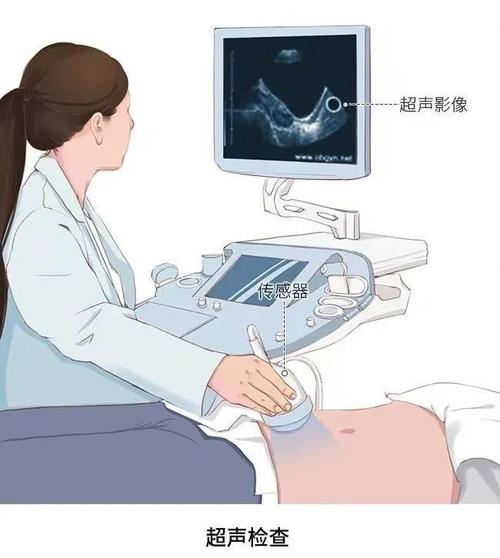 孕期宫颈检查具体查哪些指标?能提前发现哪些潜在风险?-第2张图片-郑州医学网 孕期宫颈检查具体查哪些指标?能提前发现哪些潜在风险?-第2张图片-郑州医学网
