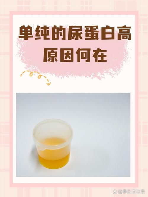 儿童尿蛋白高是肾脏出问题了吗？家长该如何应对？-第3张图片-郑州医学网