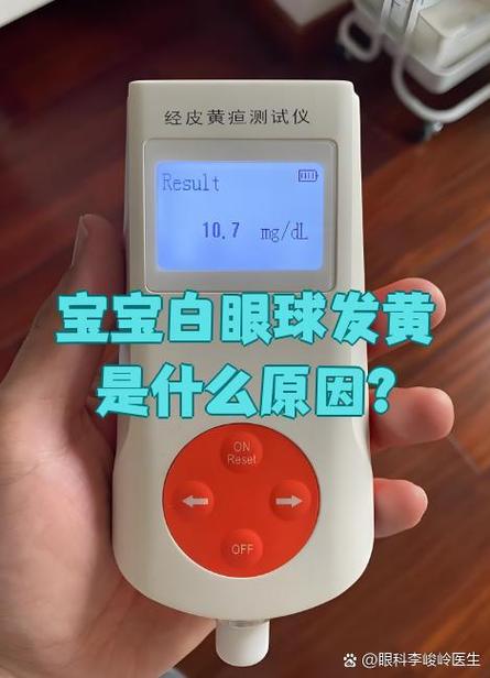 新生儿眼珠发黄是黄疸吗？需要就医检查吗？-第3张图片-郑州医学网