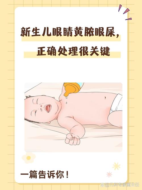 新生儿眼珠发黄是黄疸吗？需要就医检查吗？-第1张图片-郑州医学网