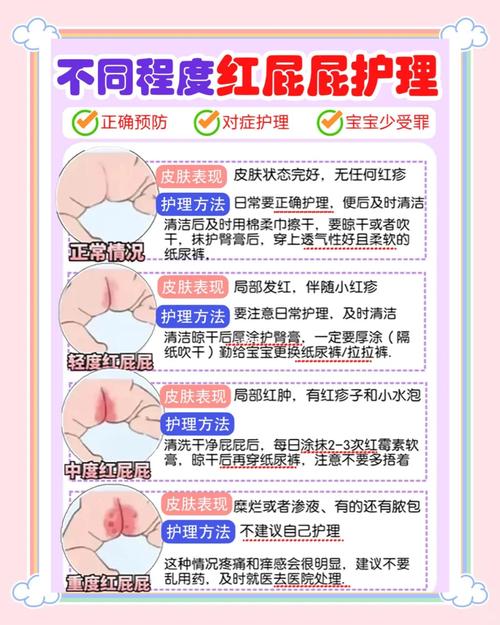 新生儿红屁股反反复复总不好，到底该怎么办才能有效护理？-第2张图片-郑州医学网