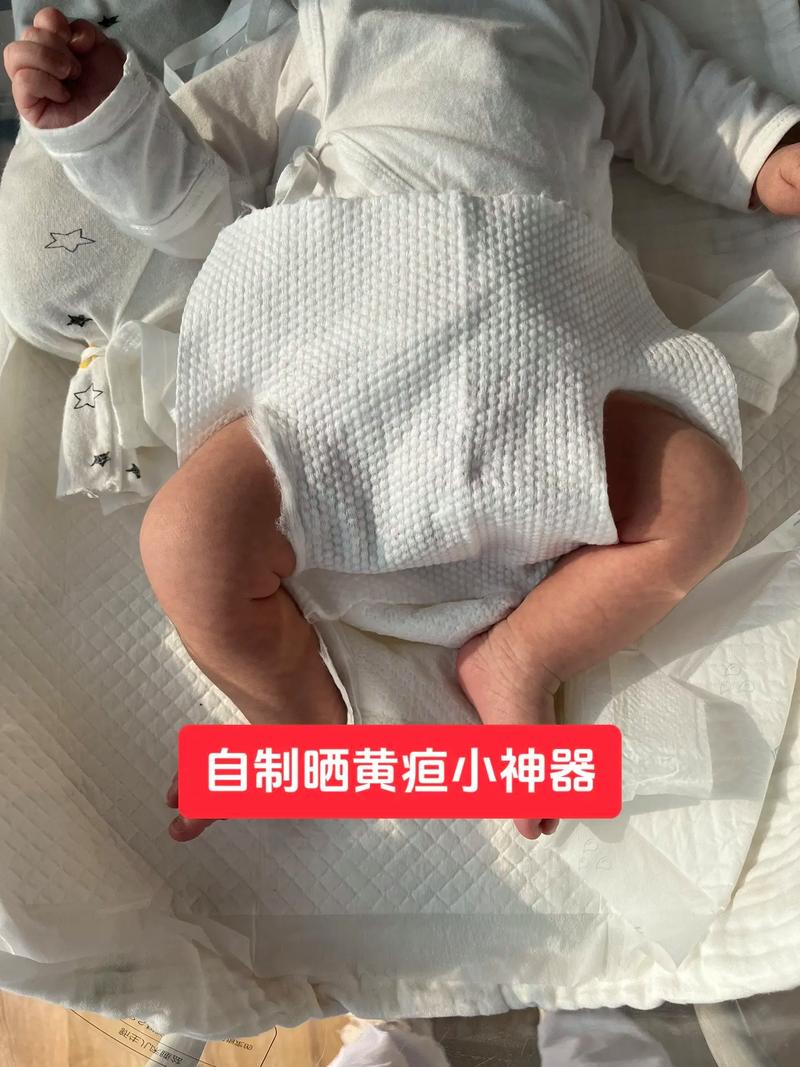 新生儿晒黄疸该晒哪里？晒背部还是晒胸部更有效？-第3张图片-郑州医学网