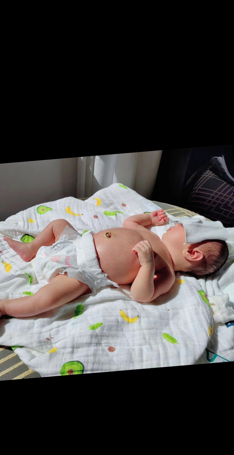 新生儿晒黄疸该晒哪里？晒背部还是晒胸部更有效？-第2张图片-郑州医学网